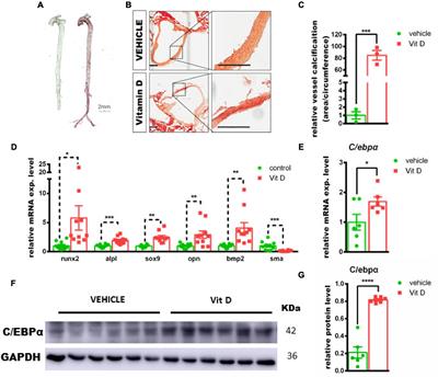 CCAAT/Enhancer-Binding Protein Alpha Is a Novel Regulator of Vascular Smooth Muscle Cell Osteochondrogenic Transition and Vascular Calcification